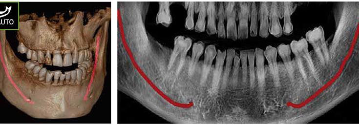 Large & Multi FOV