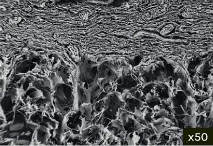 Macropore