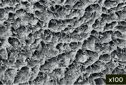Micropore