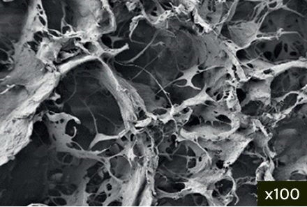 Macropore