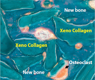 Micropore