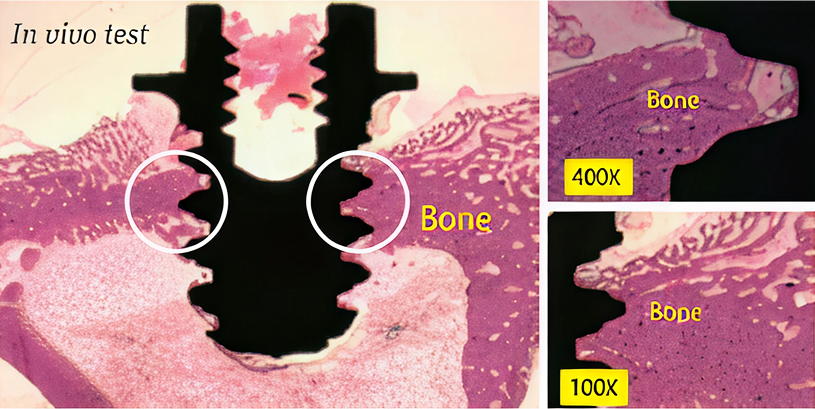 Implant Image