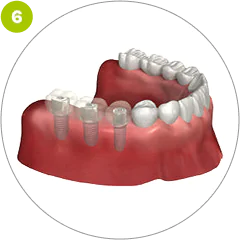 Step 6