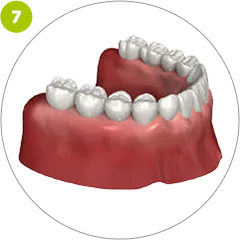 Step 7