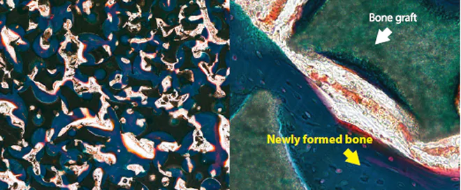 Micropore